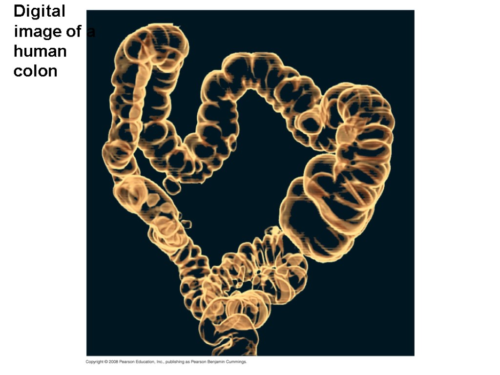 Digital image of a human colon